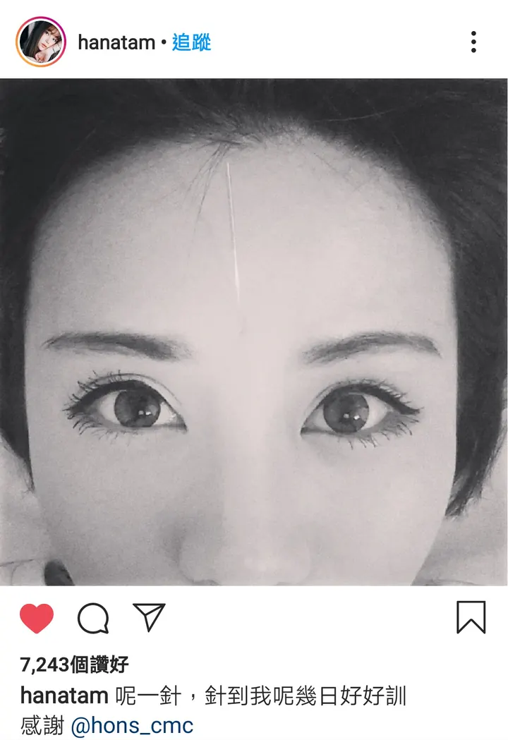 Hanatam 呢一針，針到我呢幾日好好訓，感謝 @hons_cmc